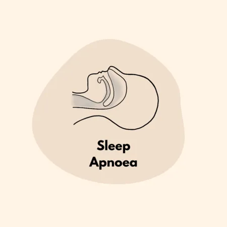 Sleep Apnea Surgery